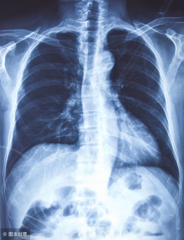 支气管扩张与慢性支气管炎有何不同点如何自行护理