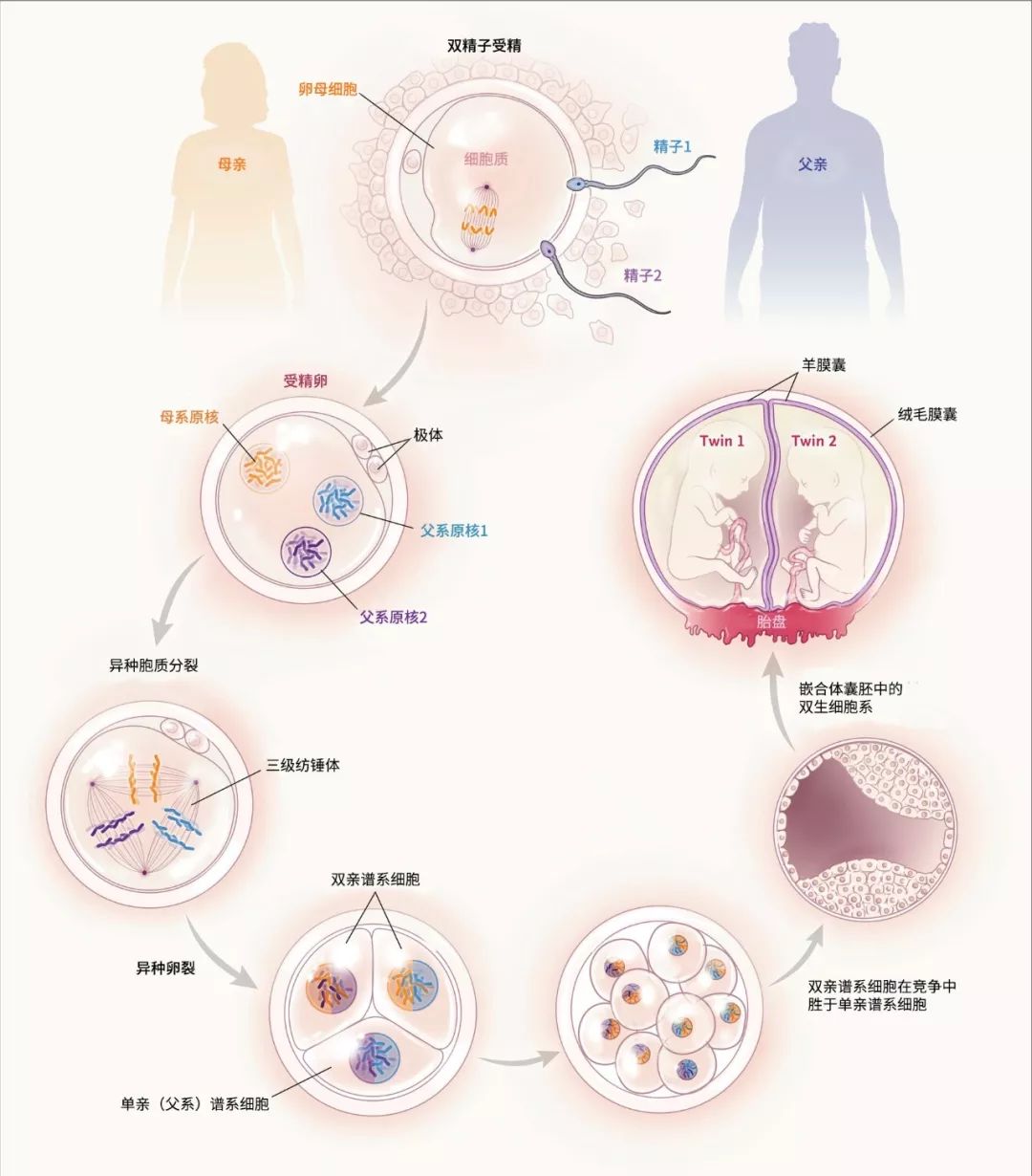 兩個精子同時進入一個卵子會怎樣罕見的半同卵雙胞胎這樣誕生