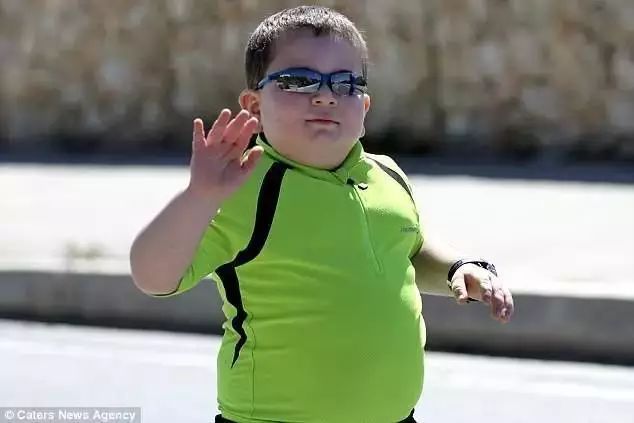 这个小男孩因为突如其来的一种罕见疾病——rohhad变得肥胖