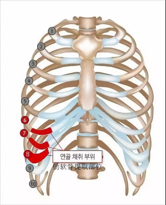 肋骨定位标志图片
