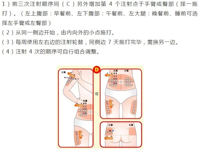 打胰岛素位置图肚子图片