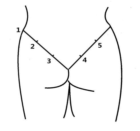 b解析:肌内注射的方法:①十字法:先从臀裂顶点向左或右侧画