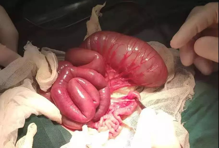 南京孕妇车祸胎儿挤出图片