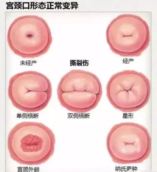 也可能出现上述表现做过宫颈,会阴,肛门等部位的疾病手术因为有的女性