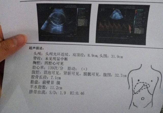 b超單上的數字很重要,能推算出孕期預產期,和胎兒體重