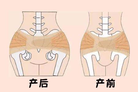 顺产下面紧致图片