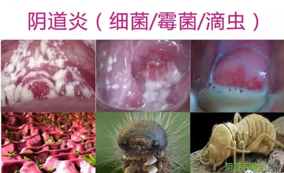 女性分泌物怎么回事图片