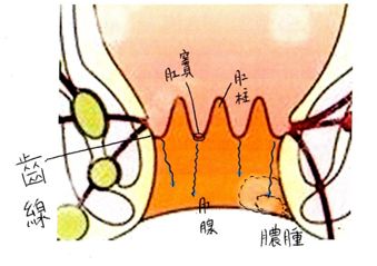 肛窦炎位置图片