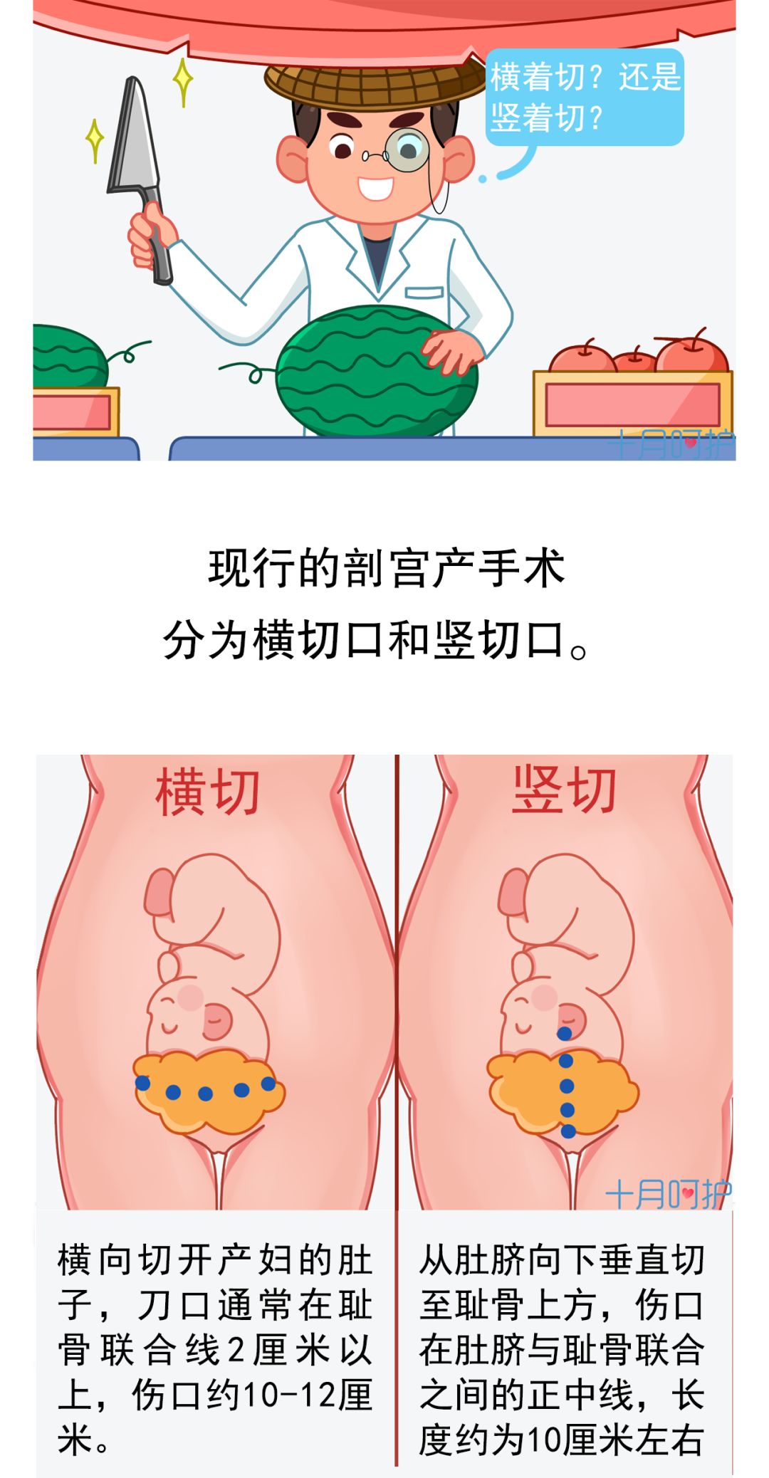 人剖腹产缝合几层图解图片