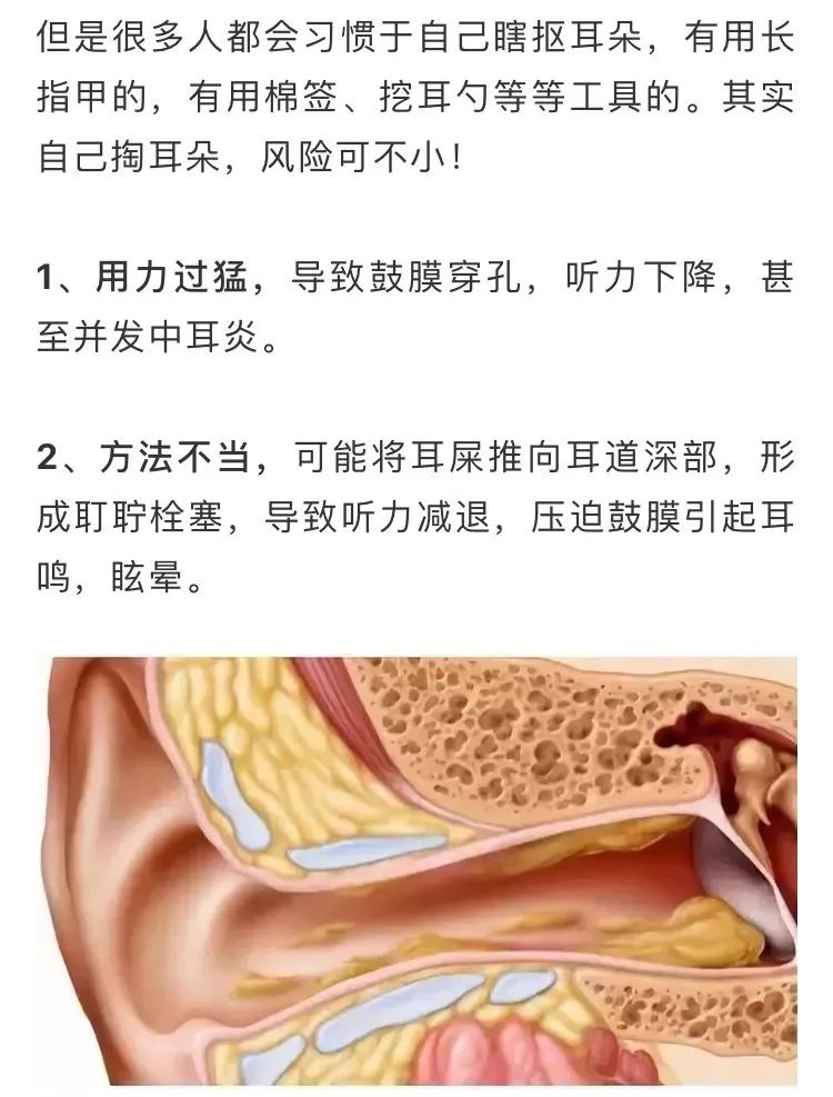 掏耳朵可以掏多深图片