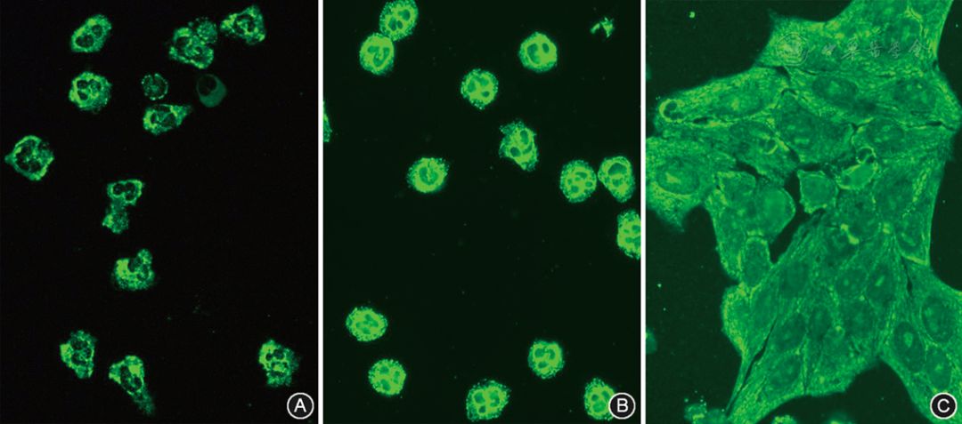 圖7抗核抗體胞漿型陽性的熒光模型(間接免疫熒光染色×200)建議9 iif