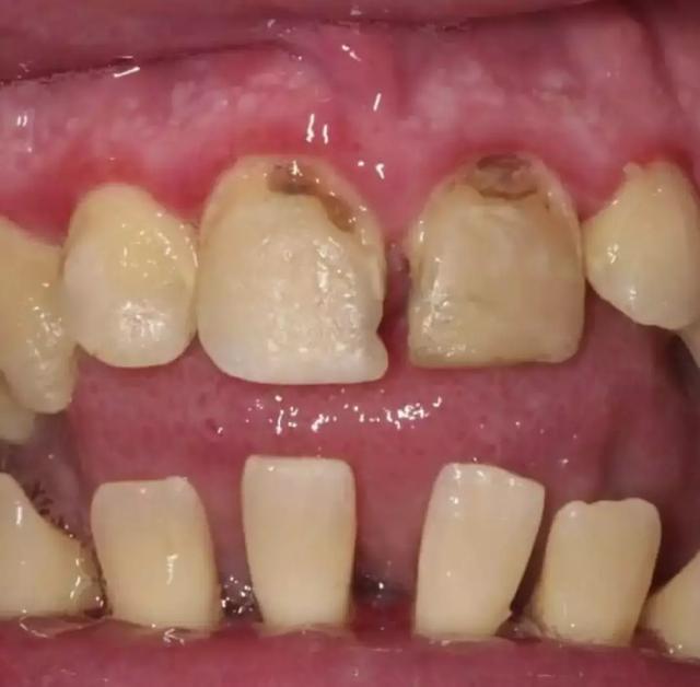 世界上最可怕的牙齿图片