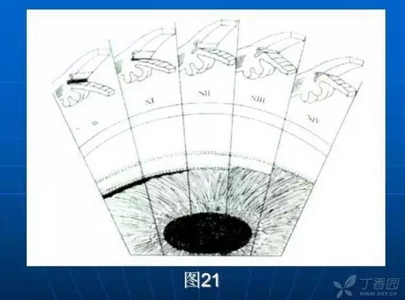 前房角镜下结构示意图图片