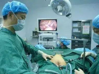 子宫肌瘤手术全过程图图片