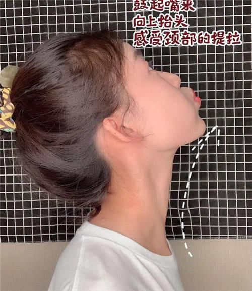 女生仰头时脖子凸起图片