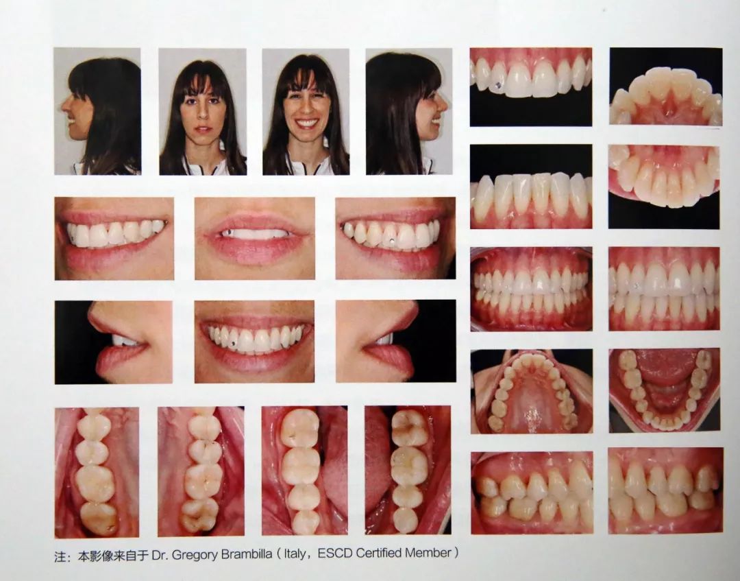 委员会图片资料来源于北京大学口腔医院刘峰老师的《口腔数码摄影》
