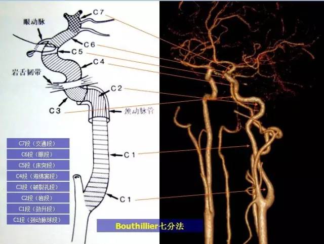颈内动脉概述颈内动脉出海绵窦后发出:眼动脉,脉络膜前动脉,大脑前