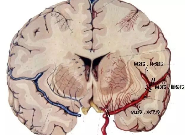 大脑中动脉分段与分支