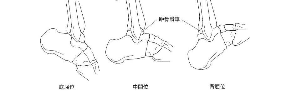 人於站立姿勢下,重心會通過兩邊踝關節的內側,使內側負重變大.