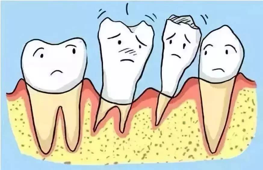 牙齿松动的原因-口腔健康杀手牙周炎