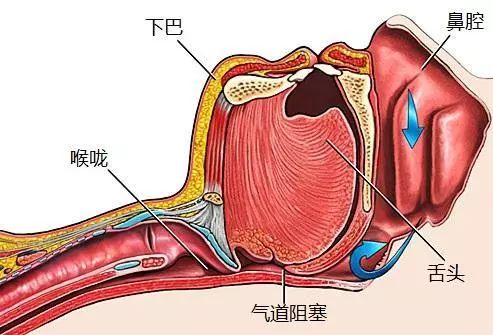 打鼾结构图片