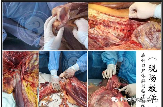 法医解剖过程实拍人体图片