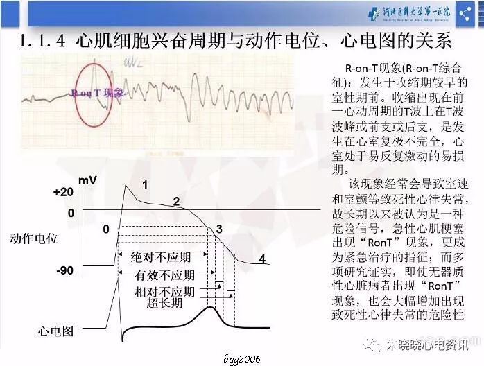 yy语音郑明奇老师心肌细胞电生理基础2019318视频图片