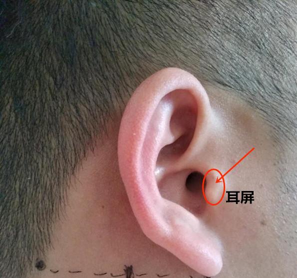 耳朵耳屏的准确位置图图片