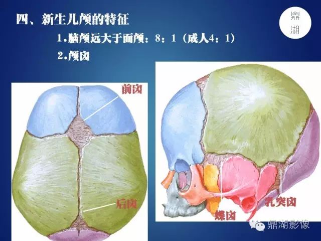 颅骨彩图解剖必点收藏