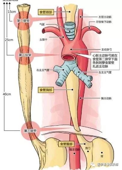 通过膈肌裂孔处左主支气管食管入口三个生理性狭窄:左心房左主支气管