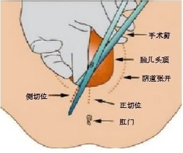 选择剖腹产的理由有很多,这一理由最奇葩!