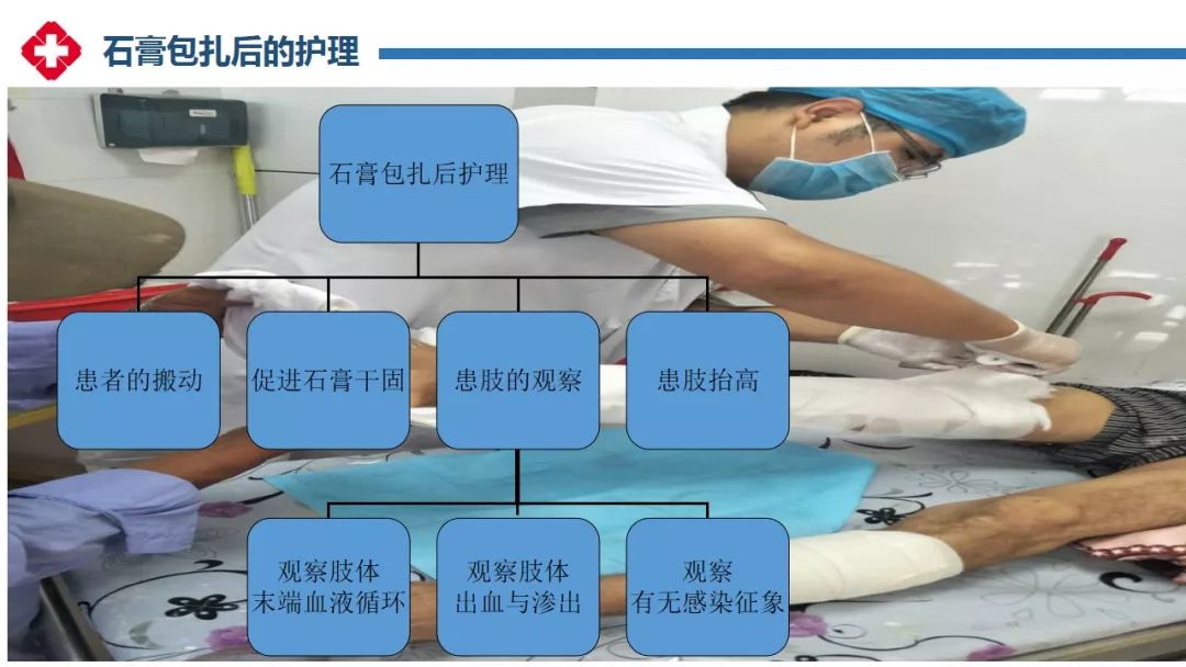 石膏绷带固定术ppt图片