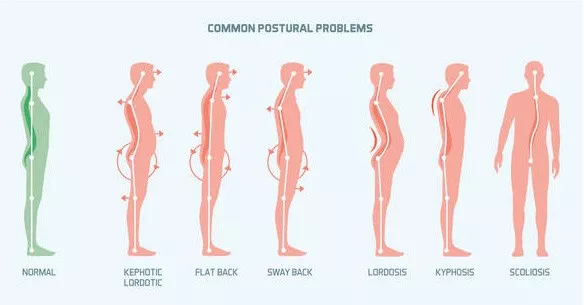 好体态有多重要？不只影响美观这么简单(图1)