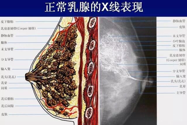 筒状乳房图片