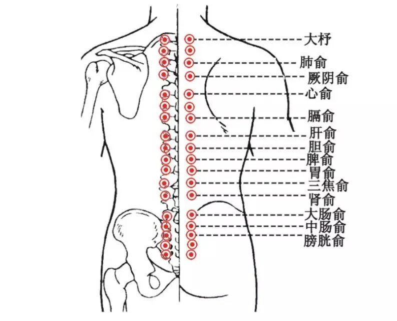 背部刮痧出痧示意图图片