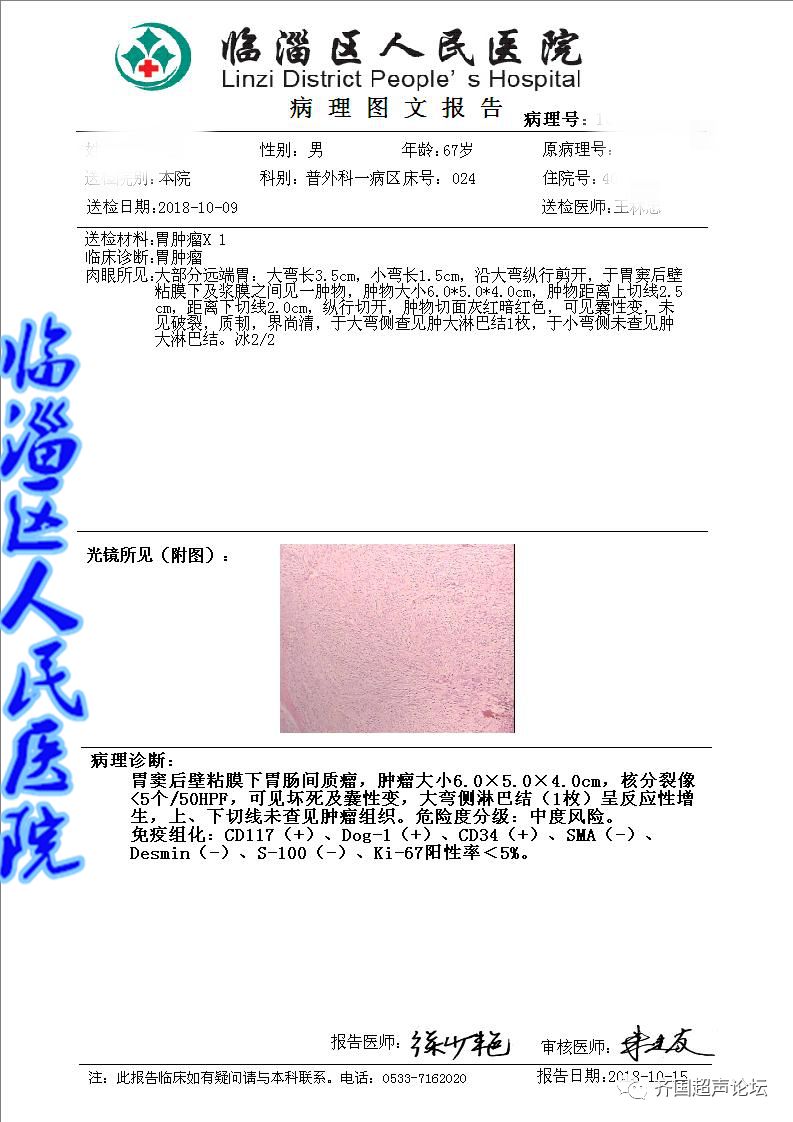 患者,男,69岁中国胃肠间质瘤诊断治疗共识(2017年版)发布!