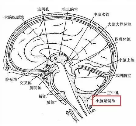小脑延髓池又称大池或枕大池,位于小脑半球后下方,延髓背面和枕鳞下部