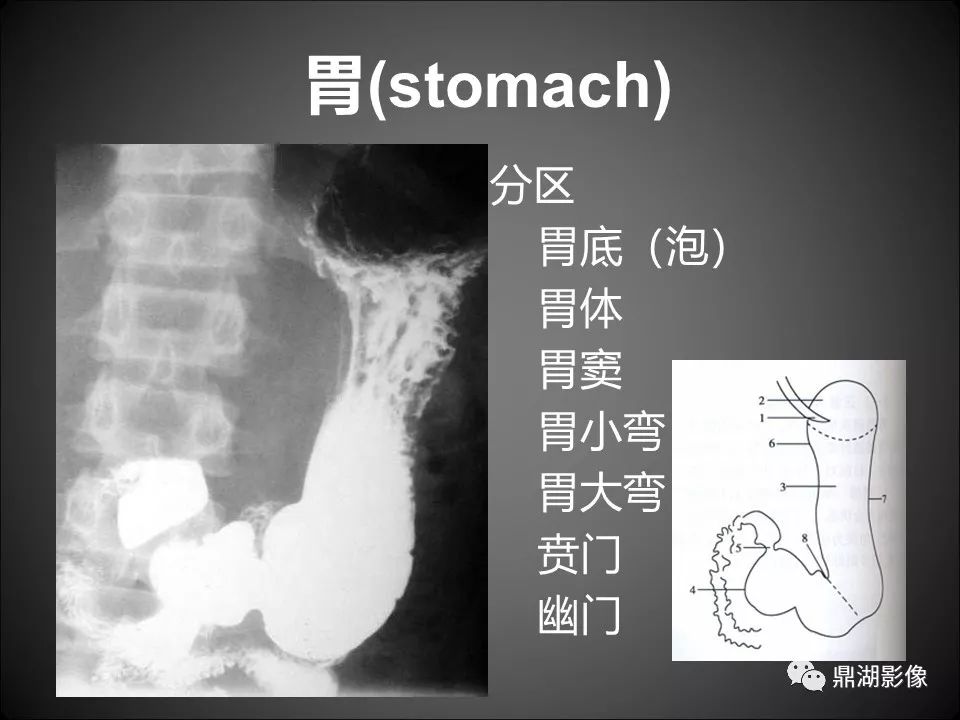 胃钡餐造影图片