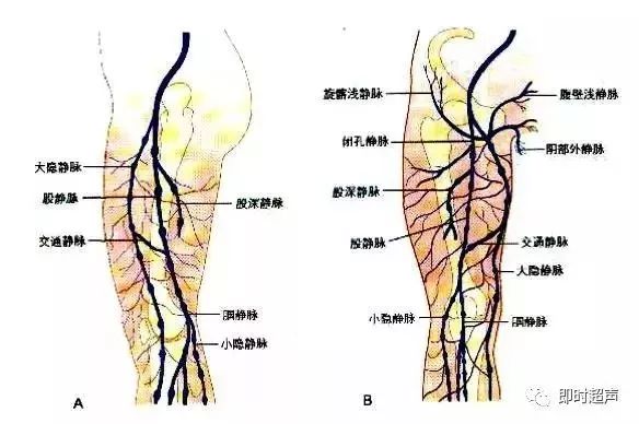 下肢深静脉的超声检查