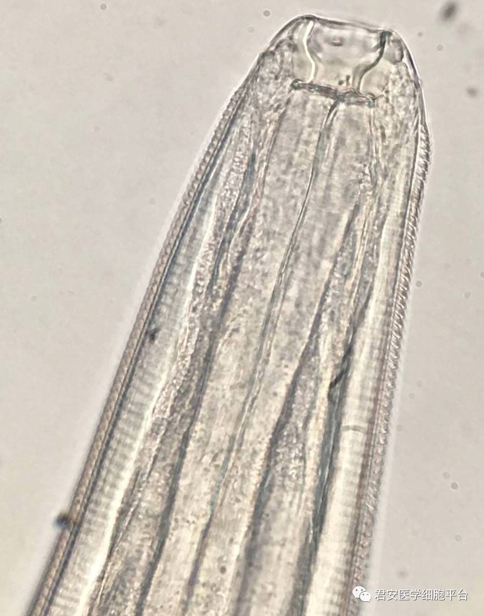 结膜吸吮线虫幼虫图片