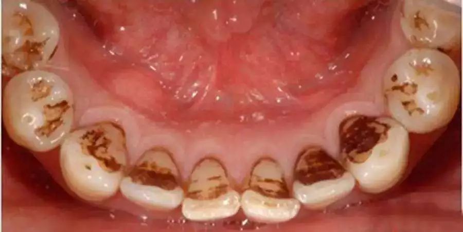 牙膏界的爱马仕黄牙口臭有救了农科院60年打造效果堪比洗牙