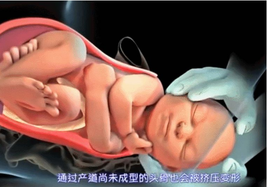 孕妇分娩全过程 顺产图片