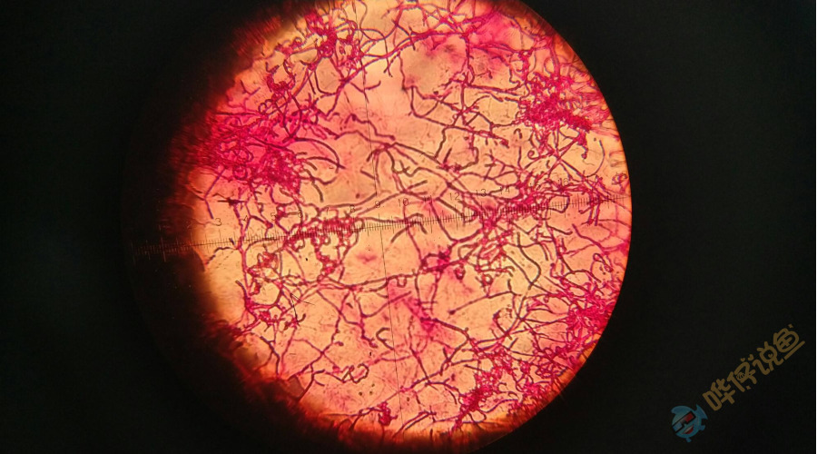 放线菌 菌落图片