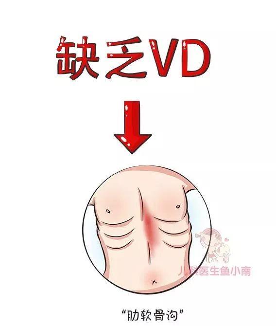 肋骨外翻宝宝平躺图片图片