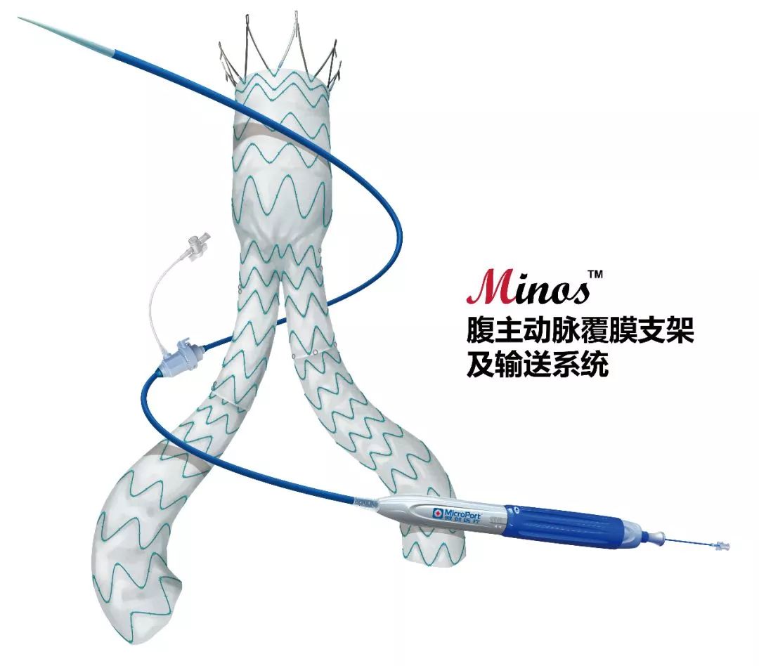 微创03心脉minos64腹主动脉覆膜支架及输送系统获批上市