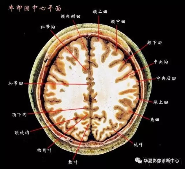 半卵圆中心手绘图图片