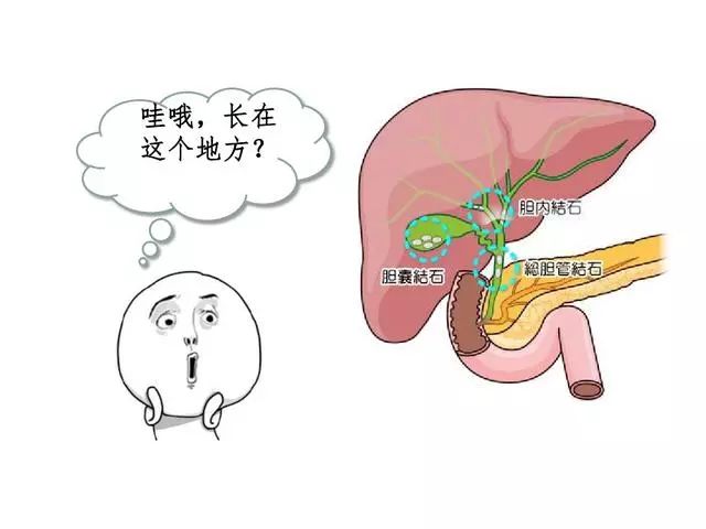 人们常说肝胆相照,胆囊就藏在肝脏的后方,是一个形状像鸭梨一样的