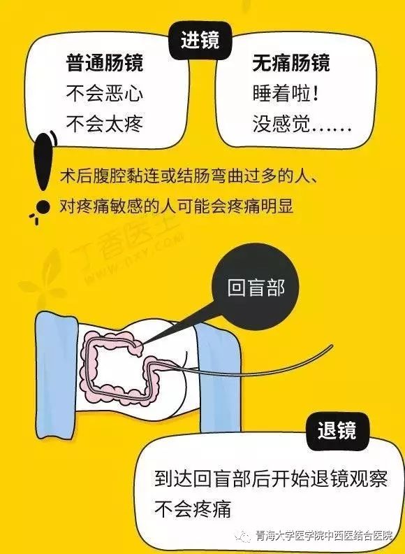 肠镜姿势 图解图片