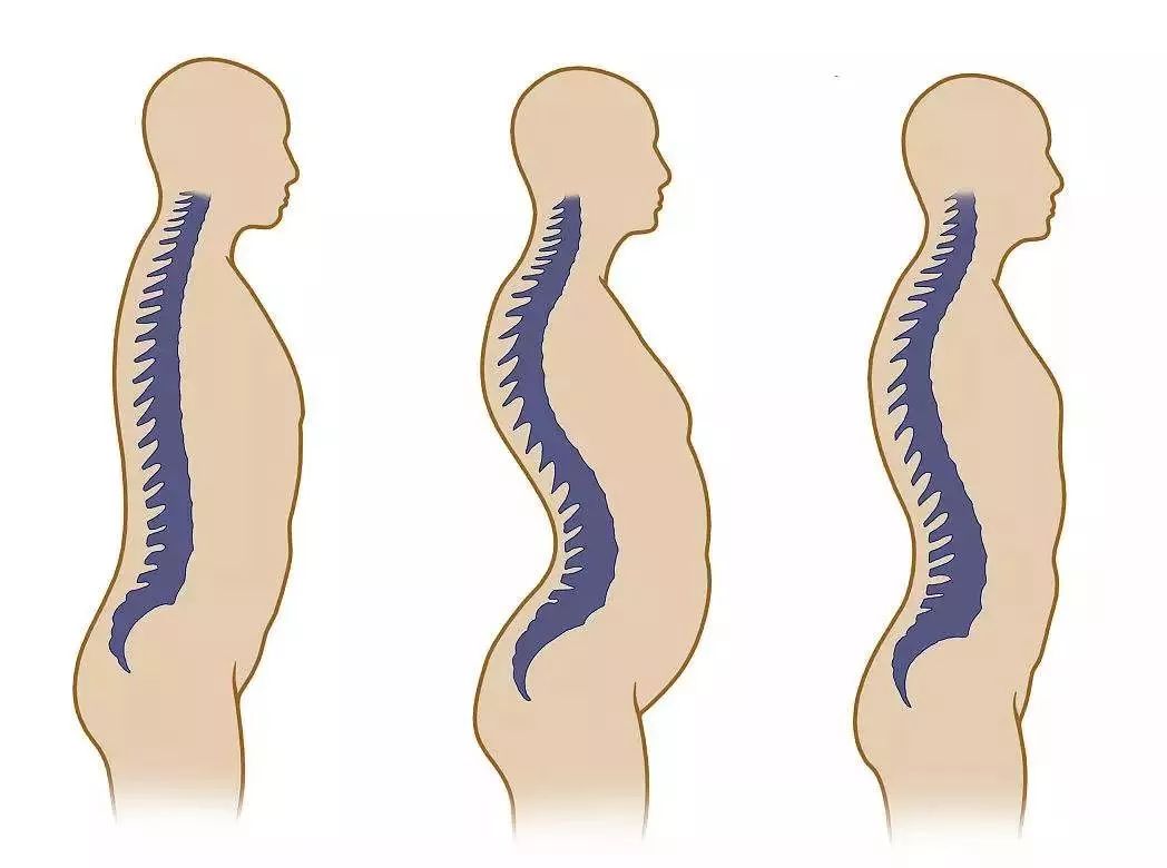 正常人平躺脊椎形状图图片