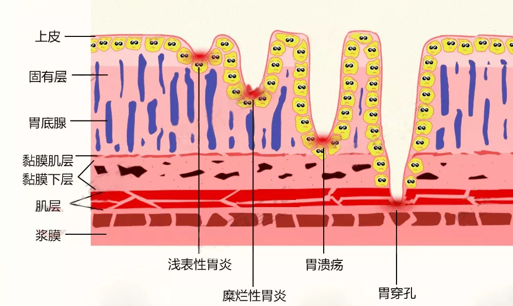 胃分层解剖图图片